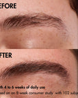 neuBROW brow enhancing serum®