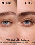 neuBROW brow enhancing serum®