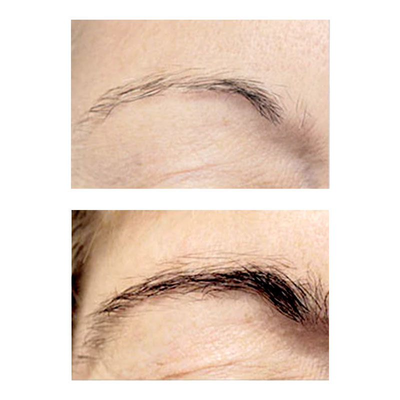 Before and after images of neuBROW product usage