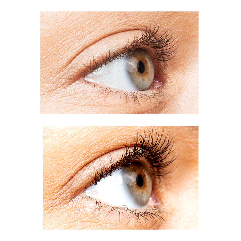 Before and after images of neuLASH product usage