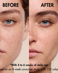 neuLASH® lash enhancing serum